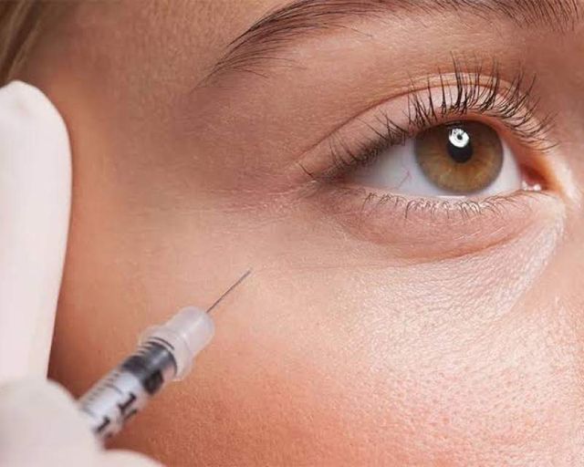 سازمان غذا و دارو نسبت به خطرات فیلرهای ارزان‌قیمت و اینترنتی هشدار داد