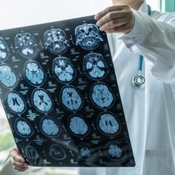 تأیید FDA برای عامل رادیواکتیو Tauklarify در تشخیص آلزایمر
